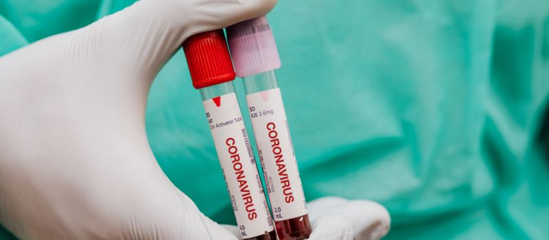 Polska rozpoczyna produkcję własnych testów