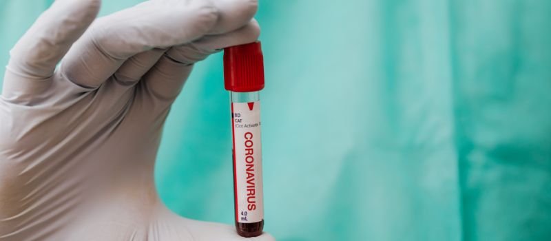 9 nowych przypadków koronawirusa w Rudzie Śląskiej